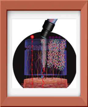 Image-mezoporacja-mezoterapia-acthyderm-schemat Image-mezoporacja-mezoterapia-acthyderm-schemat