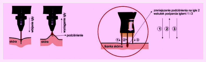 Image-makijaż-permanentny-usta-oded-maszyna Image-makijaż-permanentny-usta-oded-maszyna