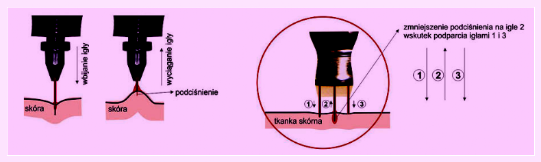 Image-makijaż-permanentny-usta-oded-maszyna